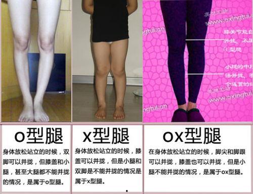 o腿型图片,探寻腿部线条的完美回归